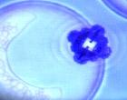 Nanosona Borg nell'atto di riparare una membrana cellulare.